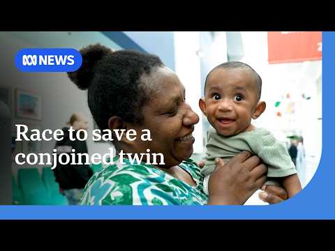 Australian doctors speak out about race to save conjoined twin from PNG | ABC NEWS thumbnail