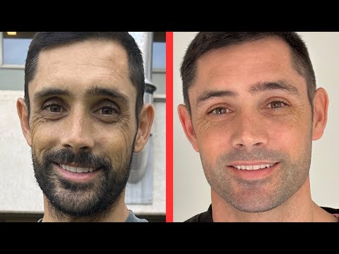 Reece's Liver Transplant Journey thumbnail