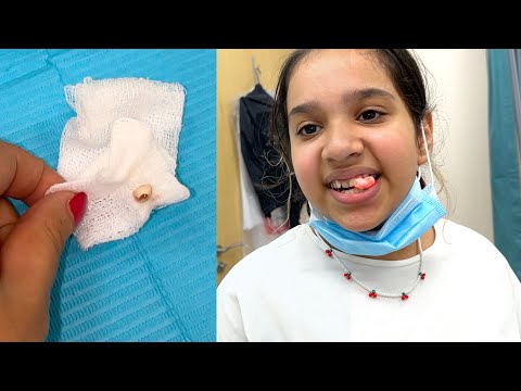 شفا خلعت سنها عند دكتور الاسنان !! thumbnail