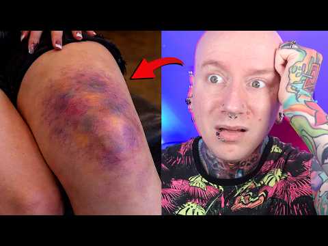 Tattooing Wounds Is A TERRIBLE Idea thumbnail