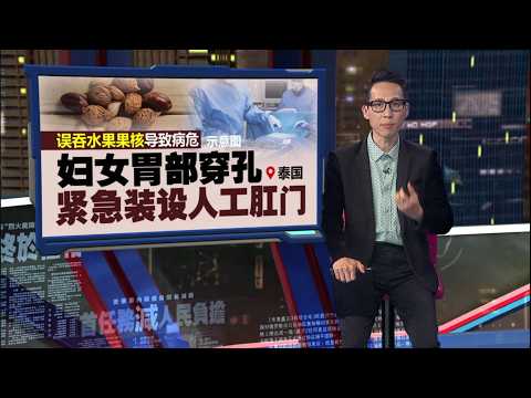 误吞水果果核致病危   妇女紧急装设人工肛门 | 新闻报报看 31/05/2026 thumbnail