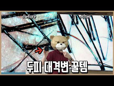 미친 성능의 신이 내린 몸 청소템 l 내돈내산 thumbnail