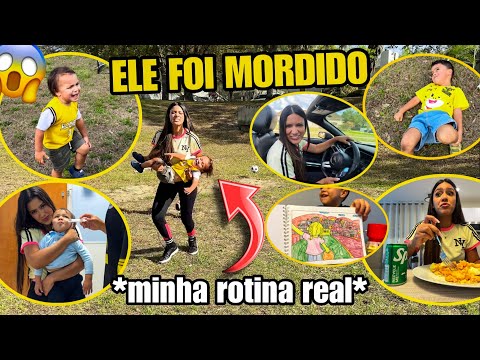 MEU FILHO FOI MORDIDO! *MINHA ROTINA REAL* 🇺🇸😱  thumbnail