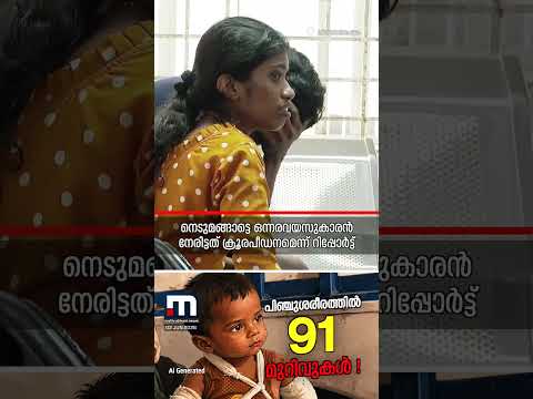 ആ പിഞ്ചുശരീരത്തില്‍ 91 മുറിവുകൾ, നട്ടെല്ലിൽ 7 പൊട്ടൽ; ഒന്നരവയസുകാരൻ നേരിട്ടത് ക്രൂരപീഡനം thumbnail