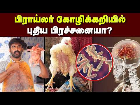 சிக்கன் சமைக்கும் போது எல்லாரும் பண்ற தப்பு இது தான்??| சாப்பிட்டால் Hospital போறது உறுதி . thumbnail