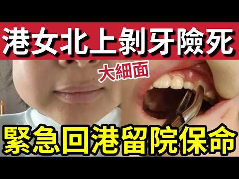 北上整牙等於自殺！港女北上剝牙「面腫窒息差點死」漏夜逃返「香港急救」醫生震驚「腫成氣球」港女後悔「只係貪平」剝牙剝到險喪命！ thumbnail