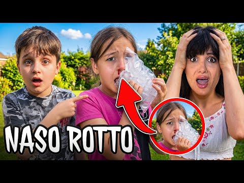 IL NASO DI EMILY… NON ERA COSÌ PRIMA! 😱 thumbnail