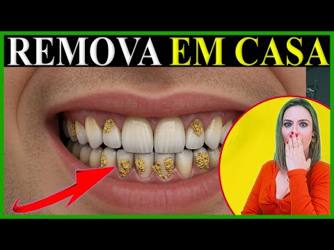 🟢3 Melhores Dicas para REMOVER TÁRTARO DOS DENTES em Casa de Forma (SUPER EFICAZ) thumbnail