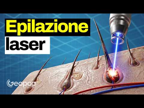 L'epilazione laser e la tecnologia che c'è dietro: come funziona sui peli e quanto è efficace thumbnail