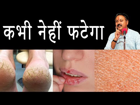 कभी नेहीं फटेंगे होंठ, एड़ियां और त्वचा || Winter Skin Care in Hindi || Rajiv Dixit Ji thumbnail