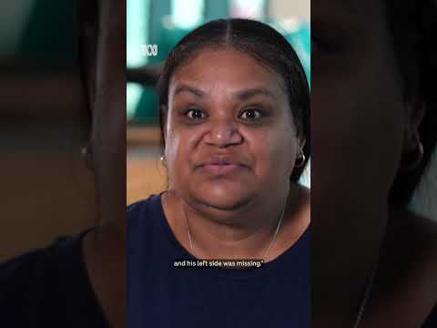 Teen survives horrific shark attack | ABC NEWS thumbnail