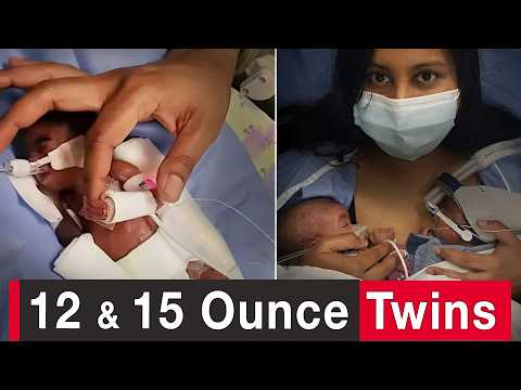 World’s Most Premature Twins: We Believed God for a Miracle thumbnail