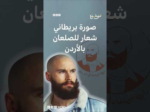 بريطاني يكتشف استخدام صورته كشعار لرابطة للصلعان في الأردن…ماذا قال لترندينغ؟ thumbnail
