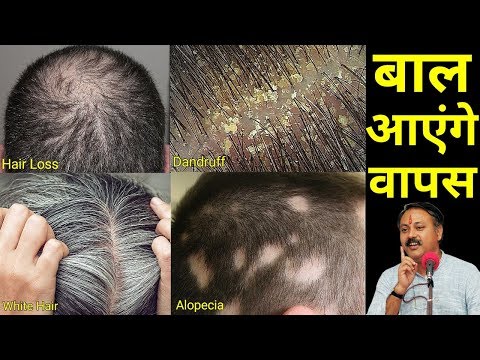 बालों की सभी समस्याओं का समाधान || Hair loss || hair loss cure || hair loss treatment thumbnail