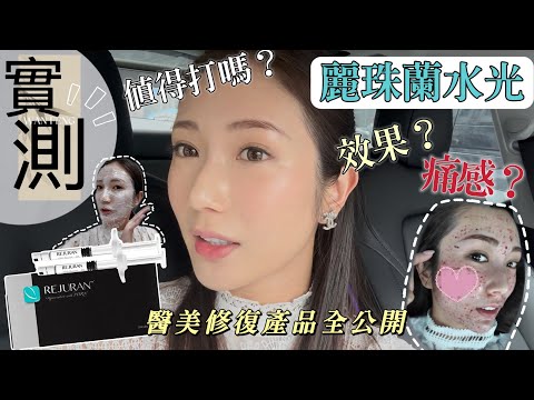 【水光針實測】韓國大熱麗珠蘭黑盒🔥痛唔痛？效果如何？值得打嗎？4ml水光槍整個修復過程記錄🧪3日修復?!保養品全公開🩸@kayan.c 蔡嘉欣 thumbnail