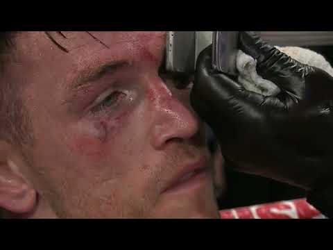 Artur Beterbiev (CANADA) VS. Callum Smith (ENGLAND) | 4K - FULL HIGHLIGHTS   #boxing #sports #combat thumbnail