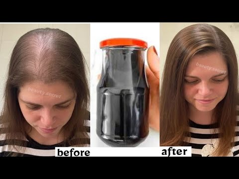 Spray it on your hair for just 2 days and your hair will grow 3 times faster. thumbnail