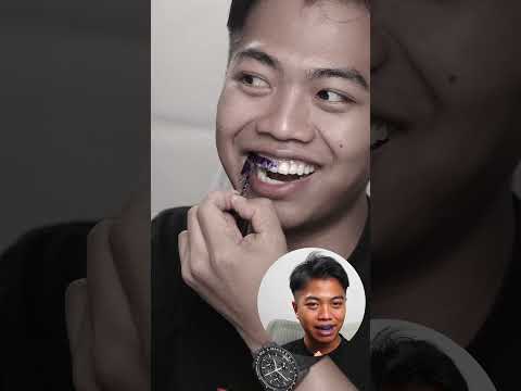 แกะออกให้ดูเลย LINEE แผ่นแปะฟัน thumbnail