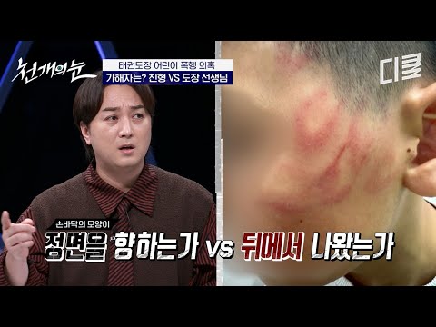 아이들끼리 낼 수 있는 상처가 아닌데...? 태권도장에서 발생한 어린이 폭행 사건의 진짜 가해자는 누구?? #천개의눈 thumbnail
