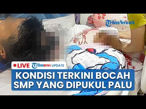 ?LIVE: Kondisi Terkini Bocah SMP seusai Dipukul Palu oleh Temannya di Singkawang, Alami Cedera Saraf thumbnail
