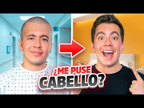 YA NO SOY CALVO - ME PUSE CABELLO thumbnail