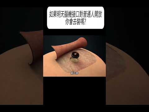 如果明天腦機接口對普通人開放，你會去裝嗎?#科普 #漲知識 thumbnail