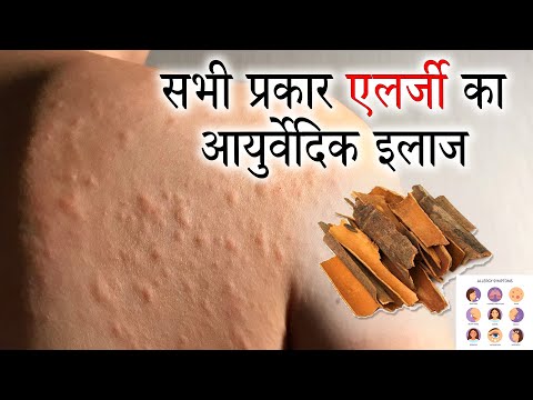 गर्म पानी में दालचीनी पीने के 23 फायदे | Allergy ki dawai | दालचीनी के फायदे और नुकसान thumbnail