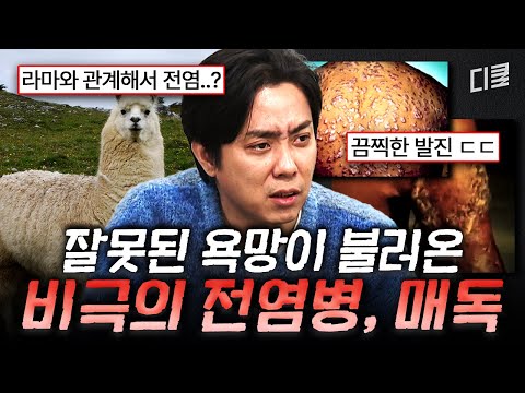 그걸 못 참고..💦 선 넘은 인간의 욕망이 불러온 최악의 감염병😱 #벌거벗은세계사 thumbnail