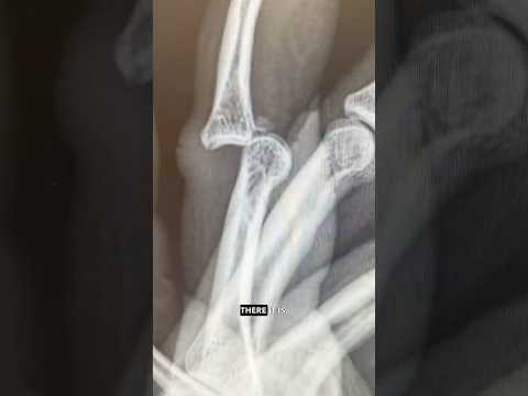 Can’t Park That Bone There… thumbnail