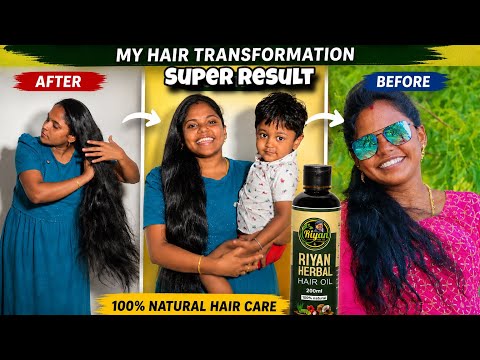 😱 My Hair Transformation Secret! RIYAN HERBAL HAIR OIL 🌿✨Watch Till End @butterfly_couples  thumbnail
