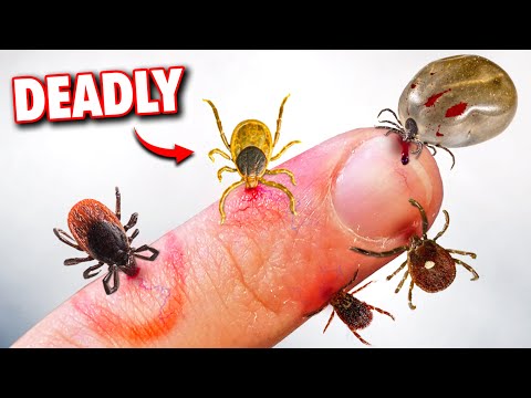 5 Deadly Tick Bites You Need To Worry About! thumbnail