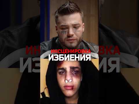Зачем Рома Желудь инсценировал побои и ножевые ранения? thumbnail