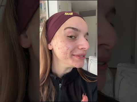 Voor het mooie meisje dat hiernaar kijkt, je kunt het allemaal zijn❤️ly thumbnail