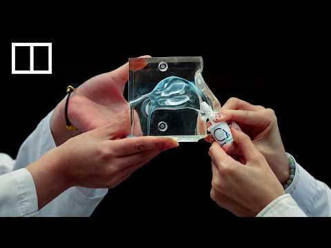 Hong Kong develops ‘world’s first’ nasal spray for rapid stroke aid thumbnail