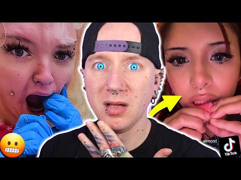 These Cheek Piercings Are Rotting In Her Face! thumbnail