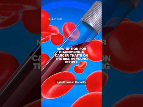 New option for diagnosing a cancer that’s on the rise in young people thumbnail