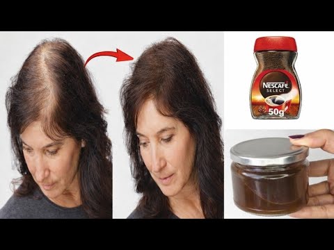 How to grow thick and long hair with just 1 egg🥚! Hair loss treatment. thumbnail