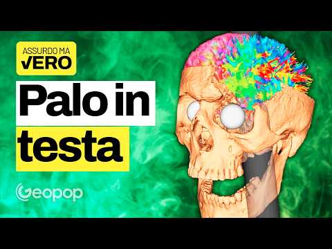 L’assurda storia dell’uomo che sopravvisse a un’asta nel cranio cambiando personalità thumbnail