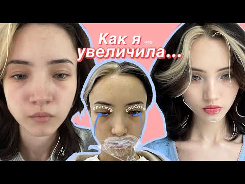 Как я увеличила губы (нервно) thumbnail