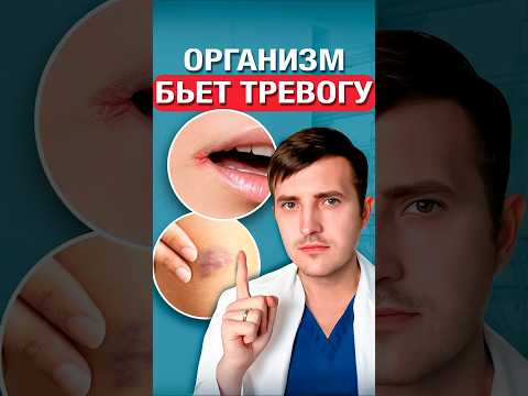 Главные признаки дефицита витаминов thumbnail