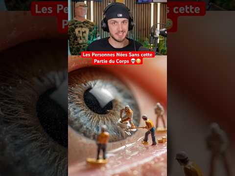 Les Personnes Nées Sans cette Partie du Corps 💀😳 thumbnail
