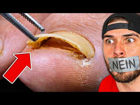 NIEMAND schafft das… (DU DARFST NICHT NEIN SAGEN!) thumbnail