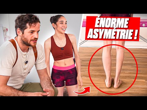 Une asymétrie énorme… mais une performance incroyable” Le cas passionnant de Brianna thumbnail
