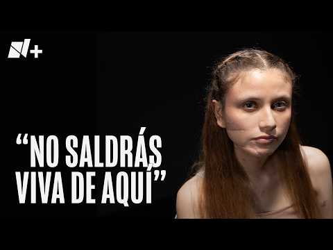 Wendy sobrevivió a un intento de feminicidio de su esposo thumbnail