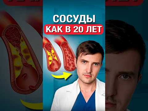 Как снизить холестерин без таблеток? thumbnail
