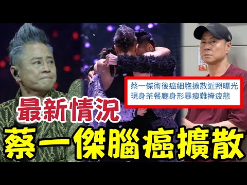 突發！蔡一傑腦癌擴散最新狀況曝光！港媒稱：面容憔悴身型消瘦！一直隱藏病情「用生命感染生命」將人生圖畫紙畫得最靚~ #草蜢 thumbnail