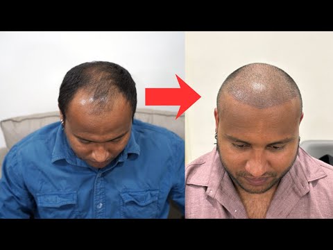 Final stage ￼??? thumbnail
