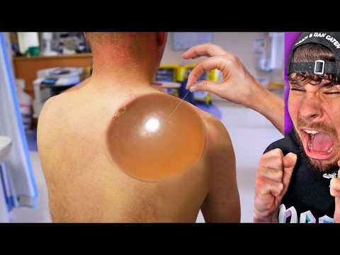 ich wette €100 du wirst weggucken.. thumbnail