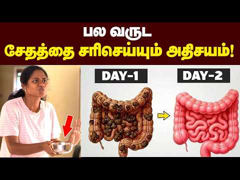 ஊறவெச்ச 2 சாப்பிடுங்க மலச்சிக்கலுக்கு Bye Bye? 70:30 Rule உங்களுக்கு கை கொடுக்கும்?Constipation thumbnail