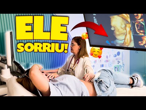 CONSEGUIMOS VER O ROSTINHO DO JOSÉ LEONARDO NESSA ULTRASSOM!! thumbnail